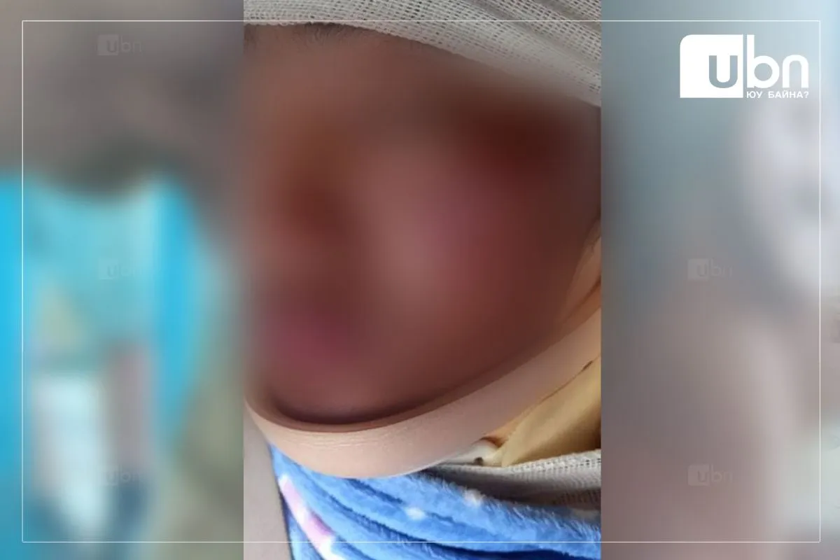 Цэрэг гэмтсэн хэргийн ДҮГНЭЛТ: Цагийн хуваарь зөрчигдсөн, холбогдох албан тушаалтнууд ХЯНАЛТ ТАВИАГҮЙ