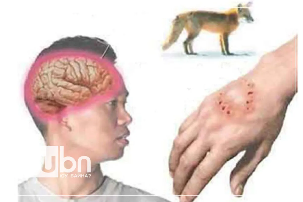 Өнөөдөр галзуу өвчинтэй тэмцэх дэлхийн өдөр тохиож байна