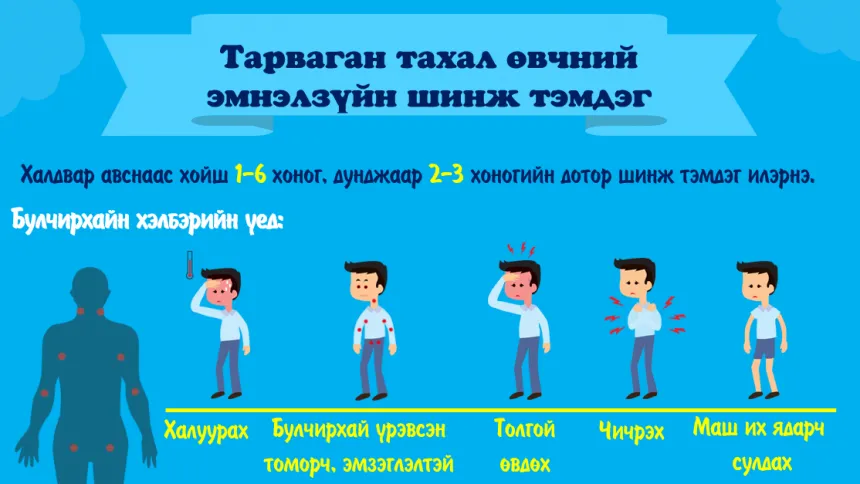 legacy:9 өглөөний уулзалт/plague_190503-o79qup48ra6roqq7m82ts60g5w4x9n6rxragm6mui0.png