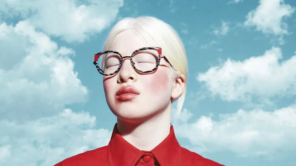 Гэр бүлдээ хаягдсан охин VOGUE сэтгүүлийн модел болсон түүх