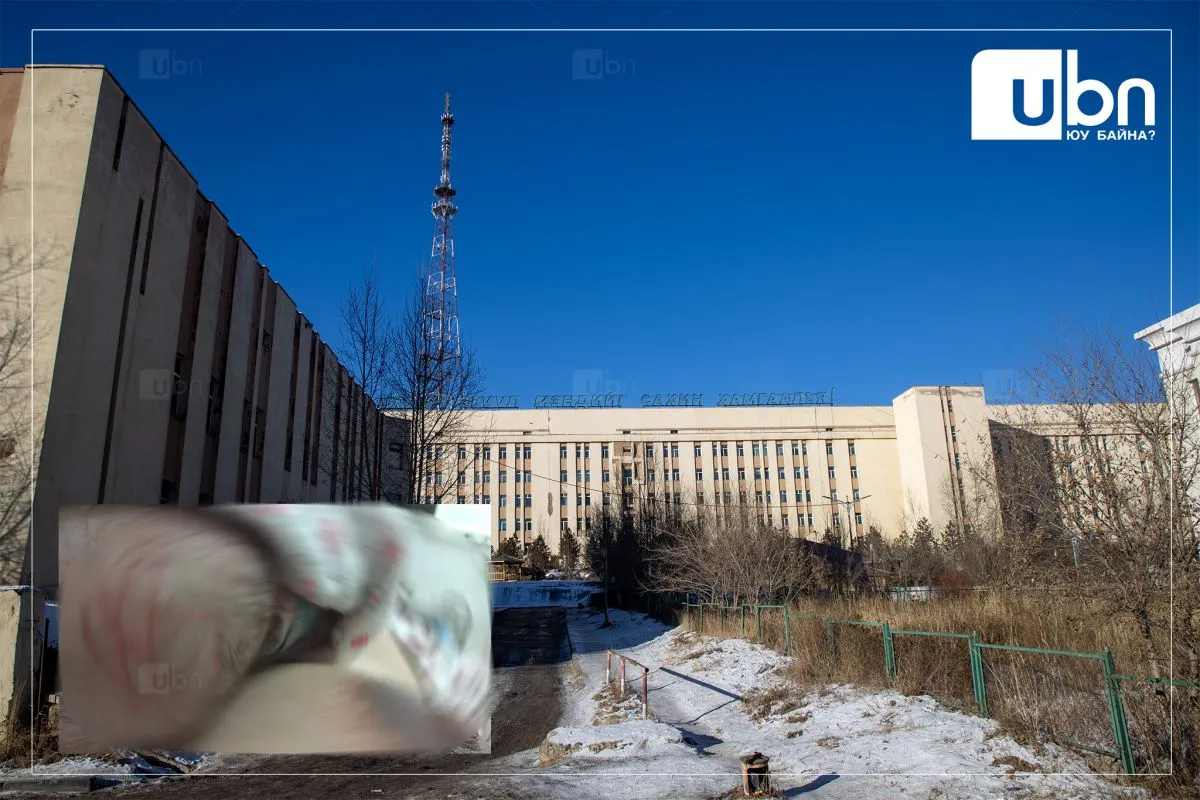ТОДРУУЛГА: Дөнгөж төрсөн нярайн зулайг зүссэн асуудал 2019 онд болсон. Эх баригч эмчид арга хэмжээ авсан