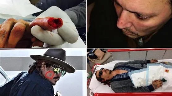 legacy:upload/images/ni/2020/02/03/-1- The Academy Music Business on Twitter- -Amber heard sliced off johnny depp-s finger- caused him to contract MRSA 3 times- burned his face with cigarette- shat on his bed- spat on him- withheld his medic-162323-756155691.png