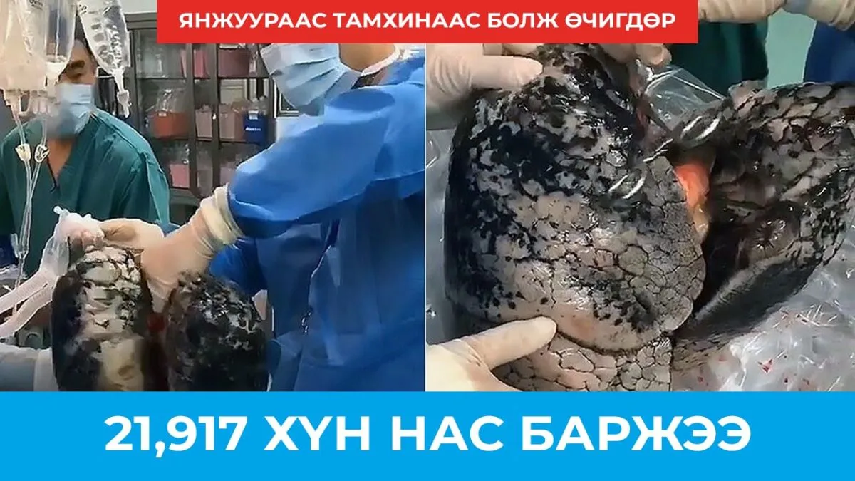 Янжуур тамхинаас болж 21917 хүн нас баржээ